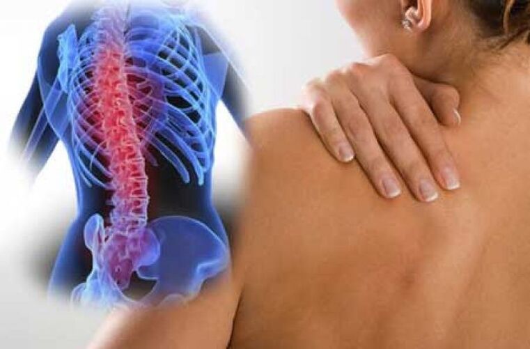 W przypadku osteochondrozy ból może promieniować do odległych części ciała