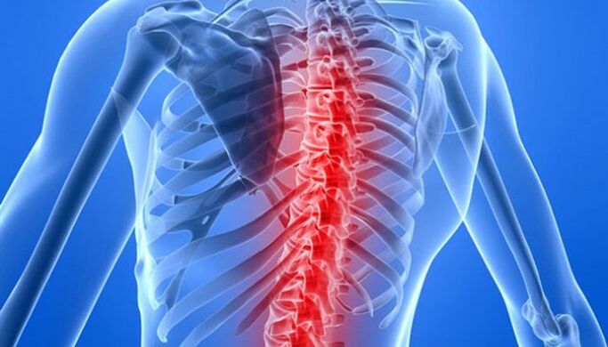 Patologie kręgosłupa są najczęstszą przyczyną bólów pleców w okolicy łopatek