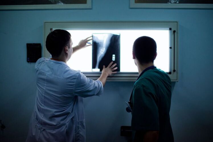 Diagnoza artrozy na x -ray