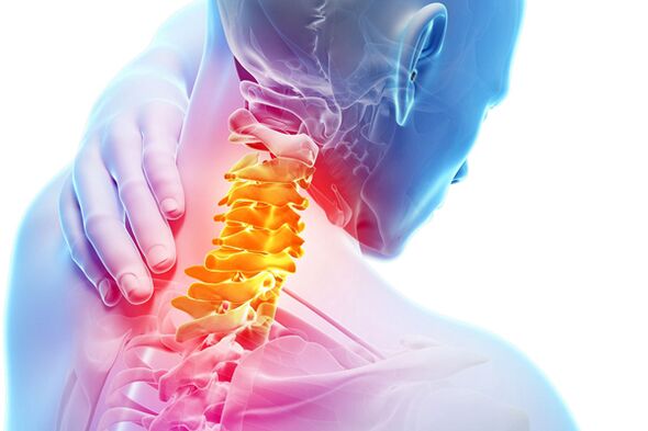 Osteochondroza szyjna