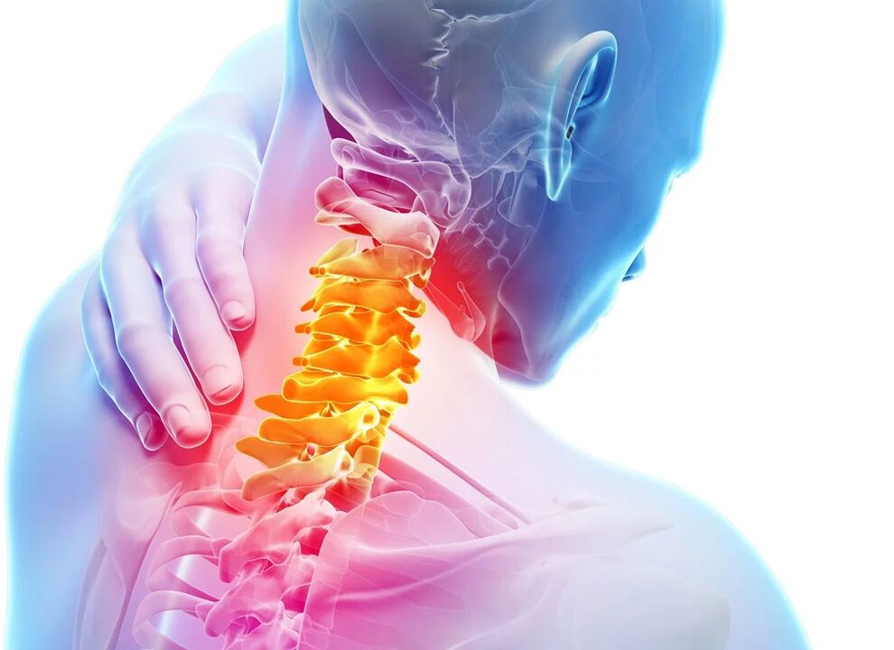 Osteochondroza szyjna