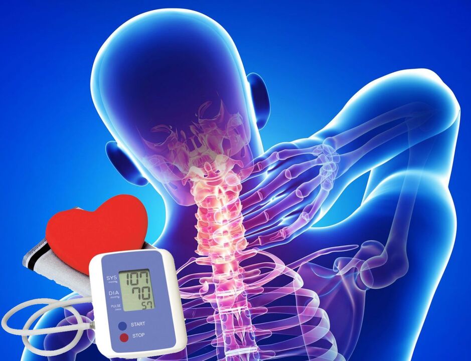 Skoki ciśnienia krwi z osteochondrozą szyjną