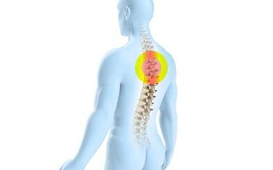 osteochondroza kręgosłupa piersiowego